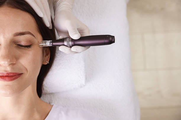How Often Should You Schedule microneedling Sessions