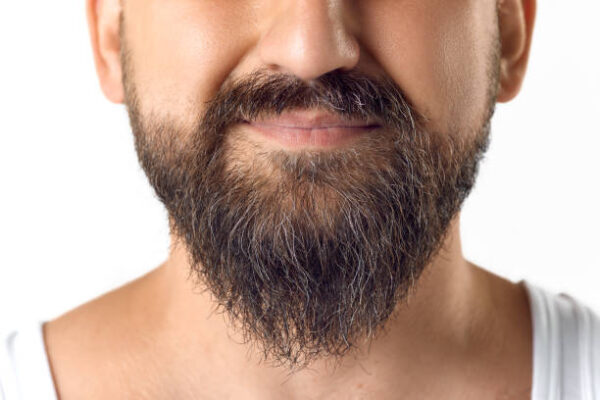 Is Beard Hair Transplant Better Than Beard Fillers for Thickness