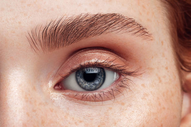 Is Eye Bag Removal Worth It for Dark Circles