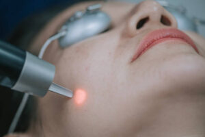 Is Laser Hair Removal Good For Ingrown-Prone Skin