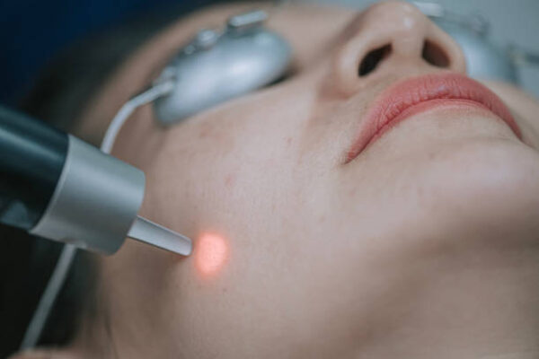 Is Laser Hair Removal Good For Ingrown-Prone Skin