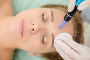 Microneedling Abu Dhabi