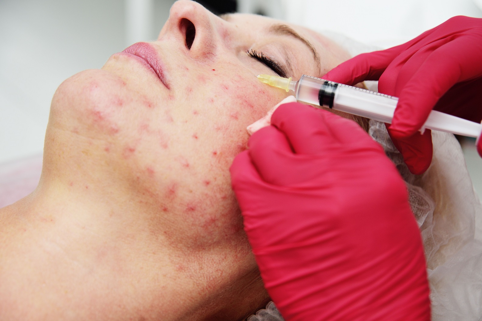 PRP treatment in Abu Dhabi
