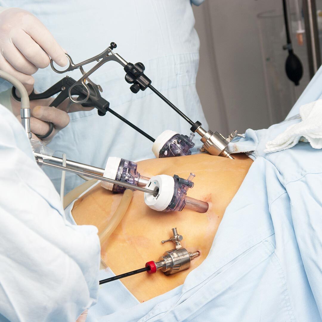 laparoscopic in Islamabad