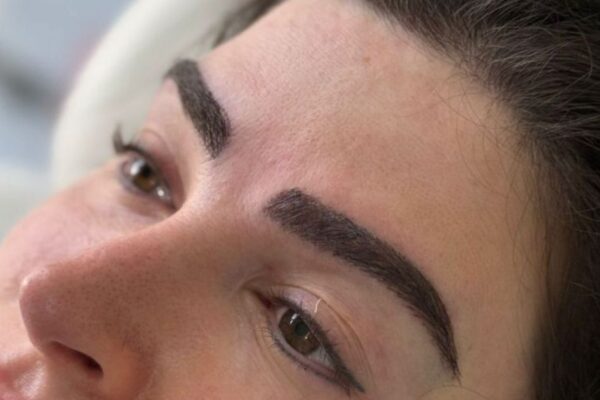Eyebrow Hair Transplant in Abu Dhabi