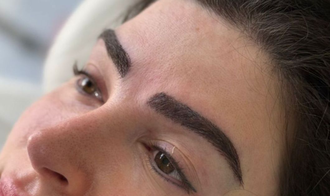 Eyebrow Hair Transplant in Abu Dhabi