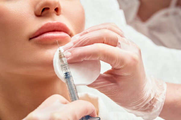 What Lip Filler Shapes Are Best for Different Face Types