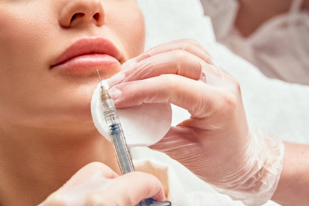 What Lip Filler Shapes Are Best for Different Face Types