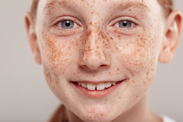 What Results Can You Expect From Pigmentation Treatment
