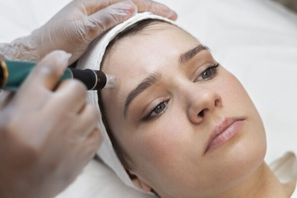 Microneedling for Acne Scars in Abu Dhabi