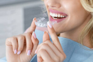 Modern Smile Correction with Teeth Aligners in Islamabad
