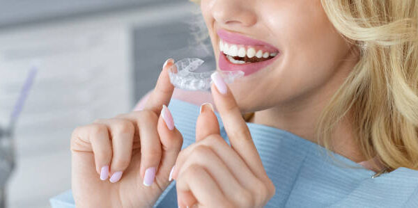 Modern Smile Correction with Teeth Aligners in Islamabad