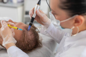 How Diet Affects Results of Exosome Hair Therapy in Islamabad