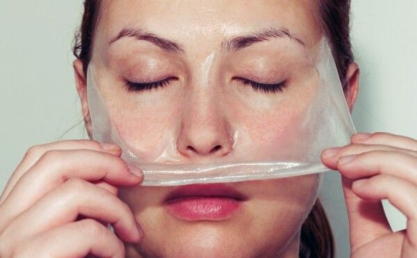 Are Chemical Peels Worth It for Sun Damage