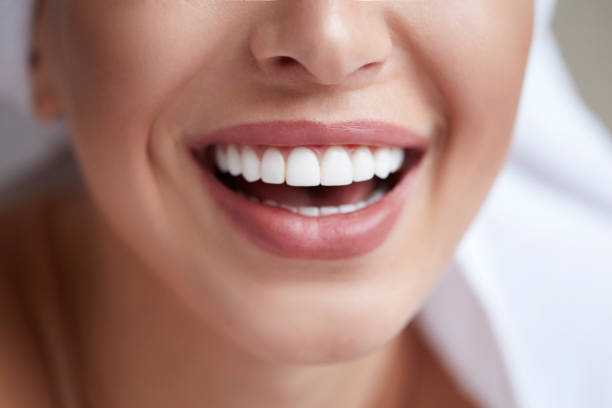 Can Teeth Whitening Brighten Uneven Tooth Color