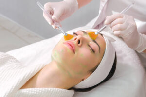 Chemical peel treatment in Islamabad