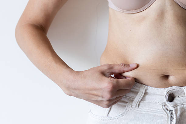 Does Fat Reduction Require Any Recovery Downtime