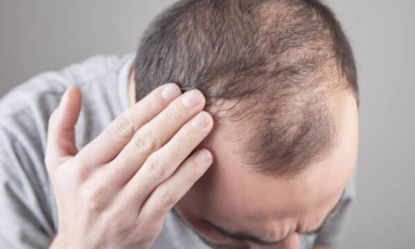 Does Hair Loss Treatment Support Natural Hair Regrowth