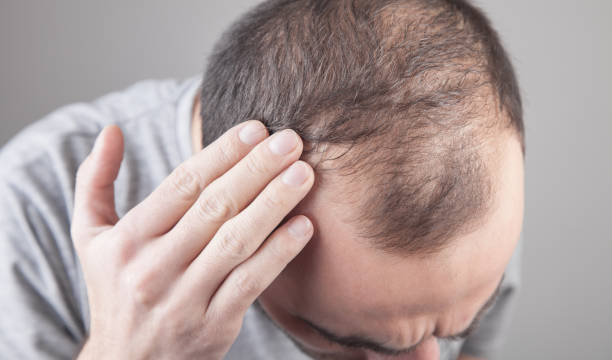 Does Hair Loss Treatment Support Natural Hair Regrowth