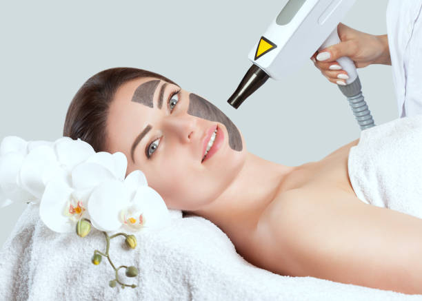 Does Laser Carbon Peel Help Oily Skin Problems