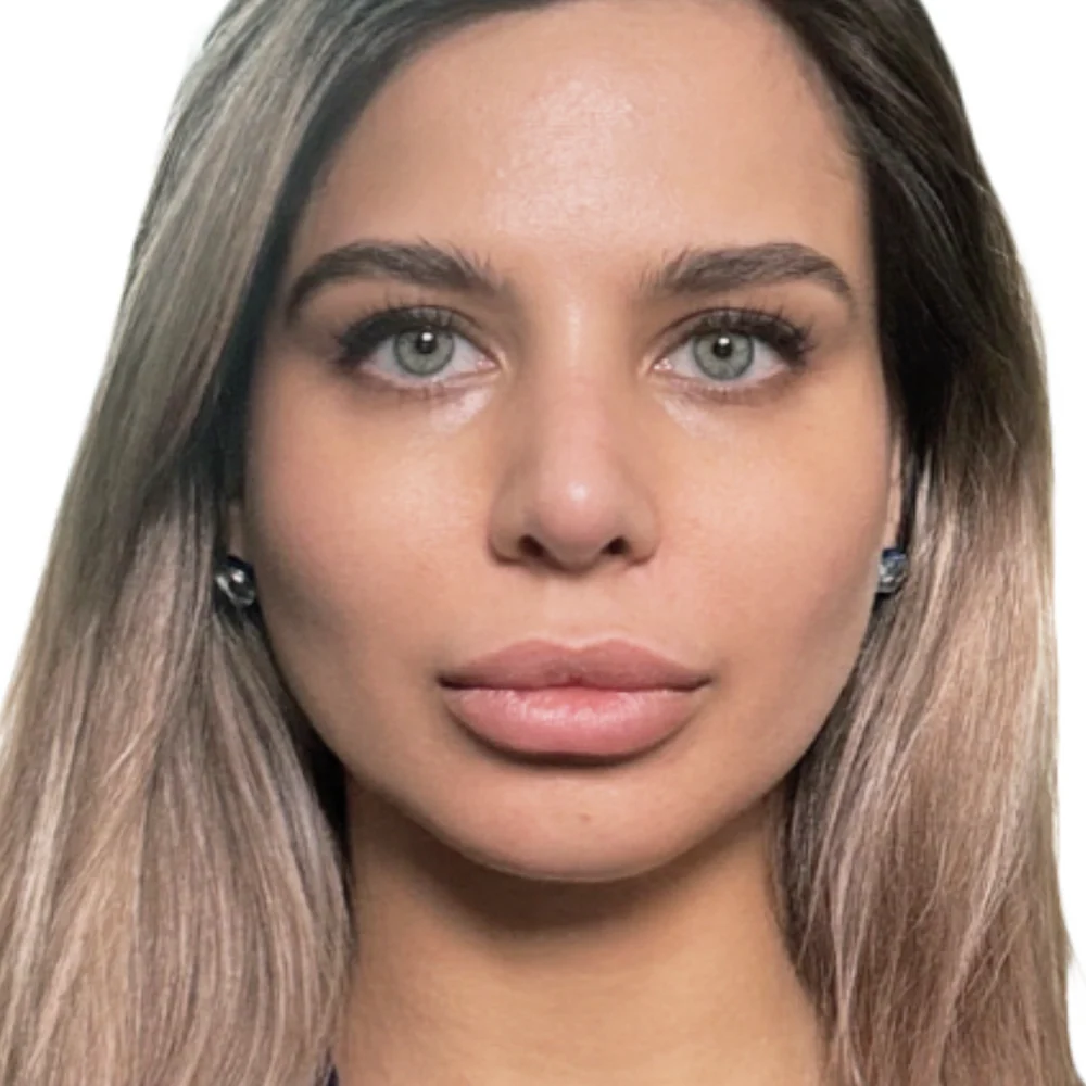 Enhance Facial Harmony with Rhinoplasty