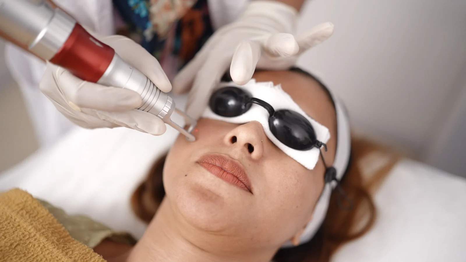 Fractional CO2 Skin Resurfacing in Islamabad