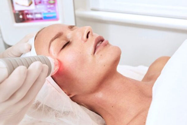 Fractional RF Micro Needling Abu Dhabi