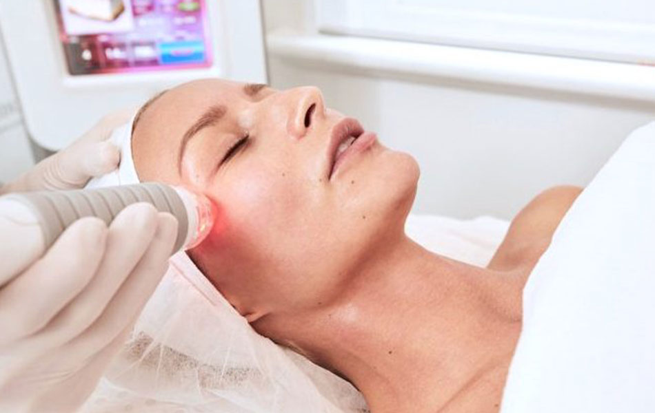 Fractional RF Micro Needling Abu Dhabi