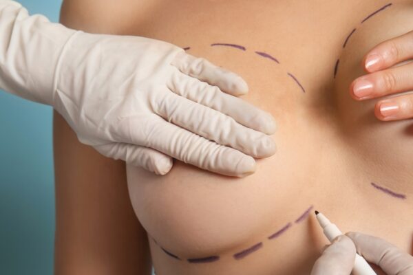 Breast Lift Surgery in Abu Dhabi