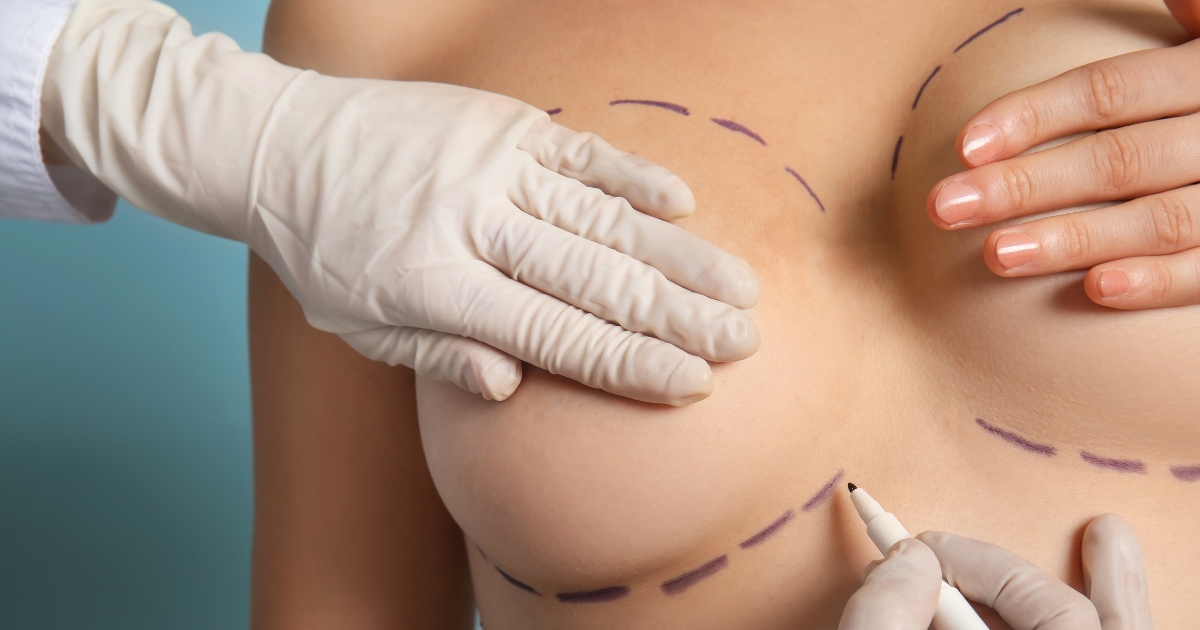 Breast Lift Surgery in Abu Dhabi