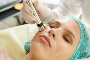 Fractional CO2 laser treatment Abu Dhabi
