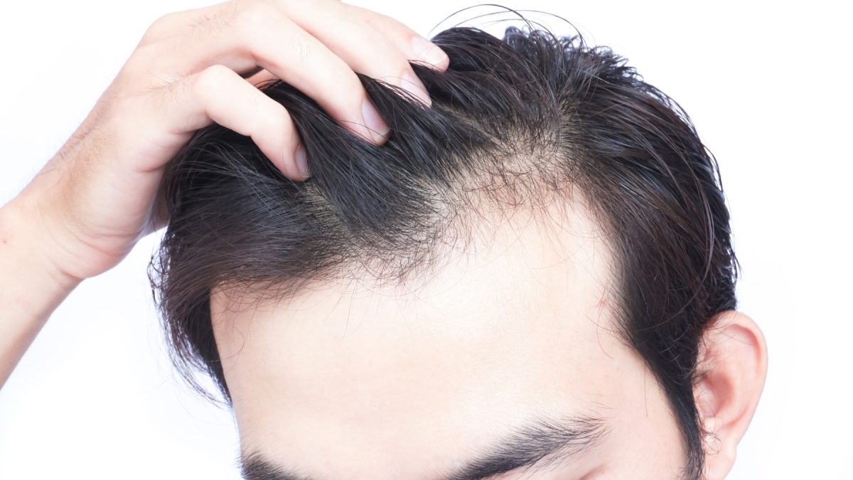 Hybrid Hair Transplant in Abu Dhabi