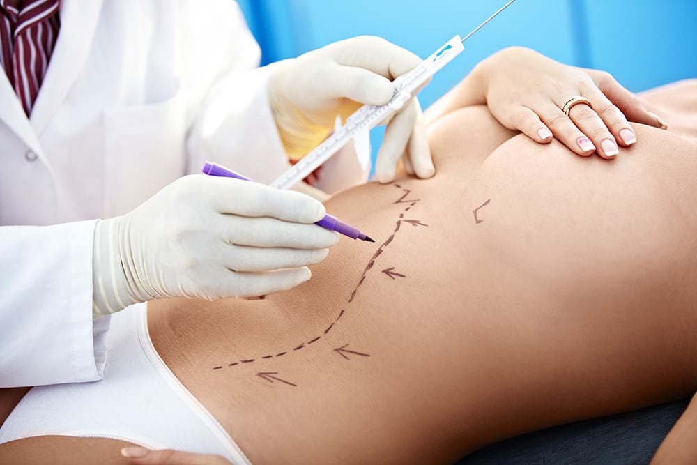 Liposuction Abu Dhabi