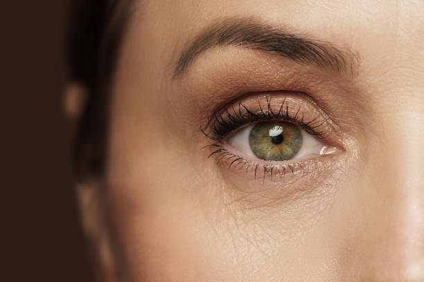 Is Eyelid Surgery Worth It for Under-Eye Bags