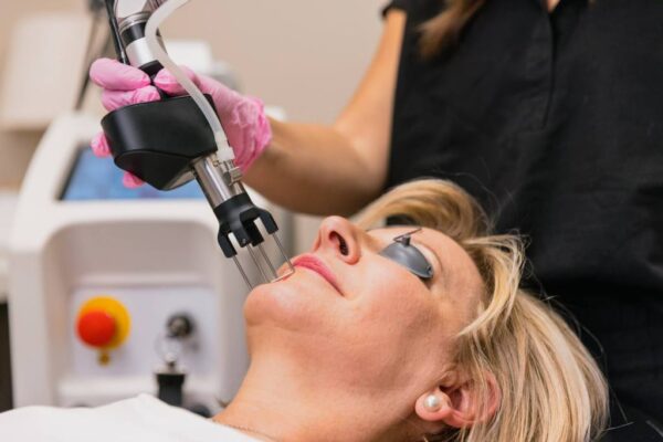 Laser Skin Resurfacing in Abu Dhabi