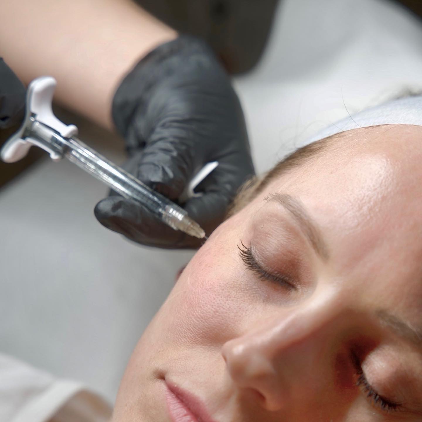Profhilo treatment Abu Dhabi