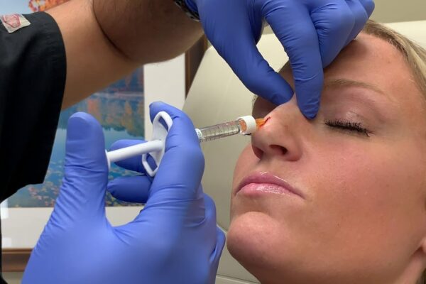 Rhinoplasty Cost in Islamabad