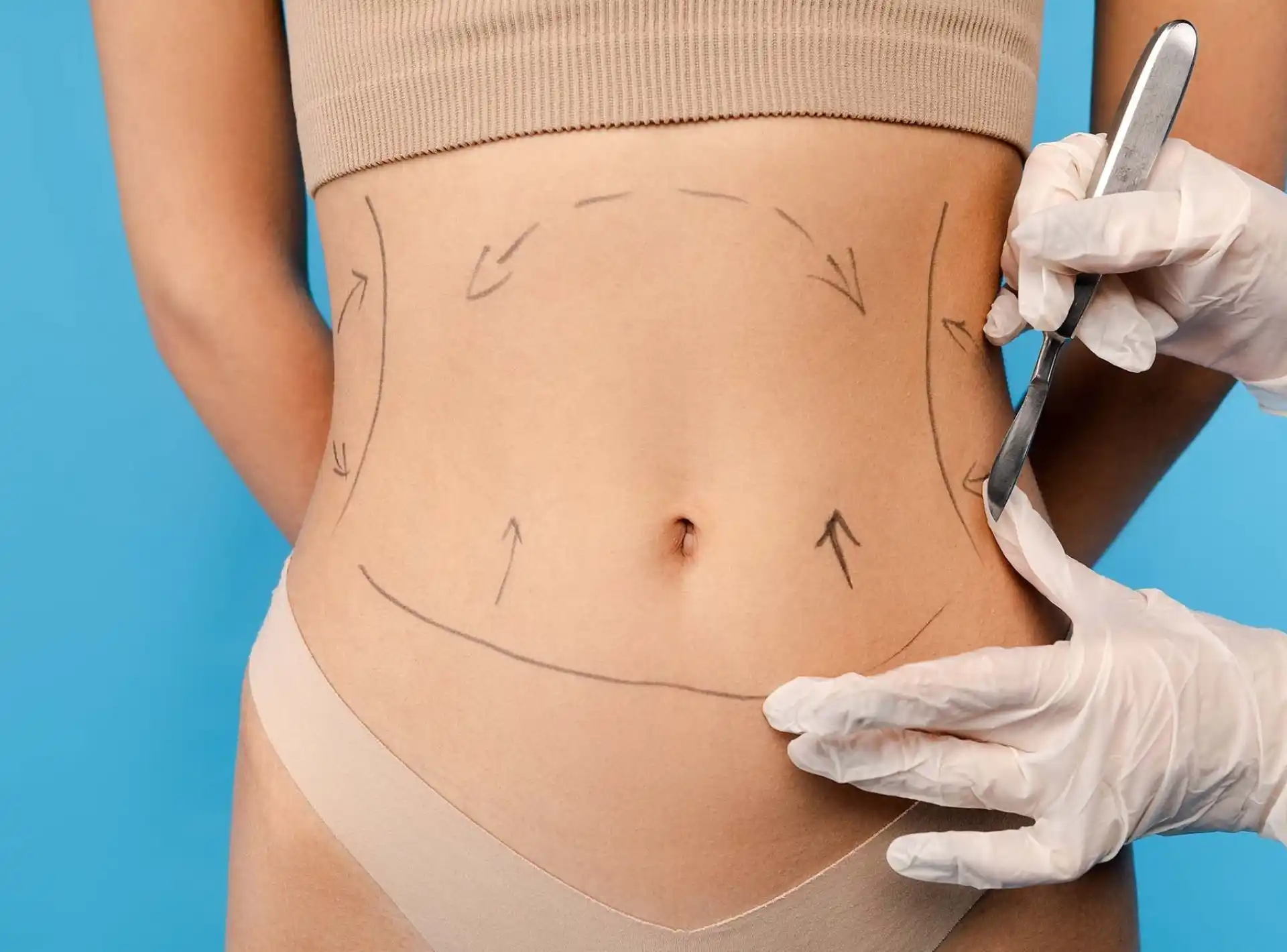Sculpt Your Ideal Shape with Liposuction and Feel More Confident Every Day