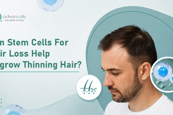 Stem-Cell-for-Hair-Loss
