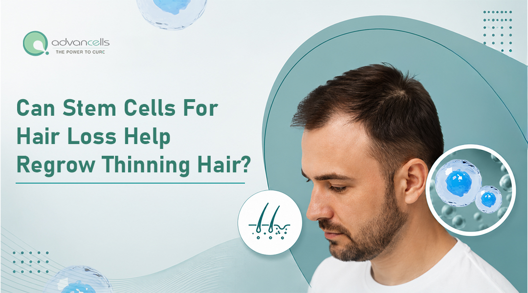Stem-Cell-for-Hair-Loss