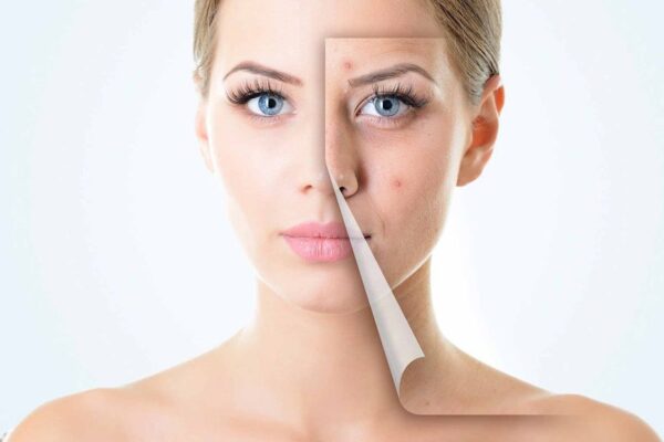 scar reduction in Bengaluru
