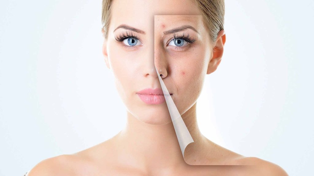 scar reduction in Bengaluru