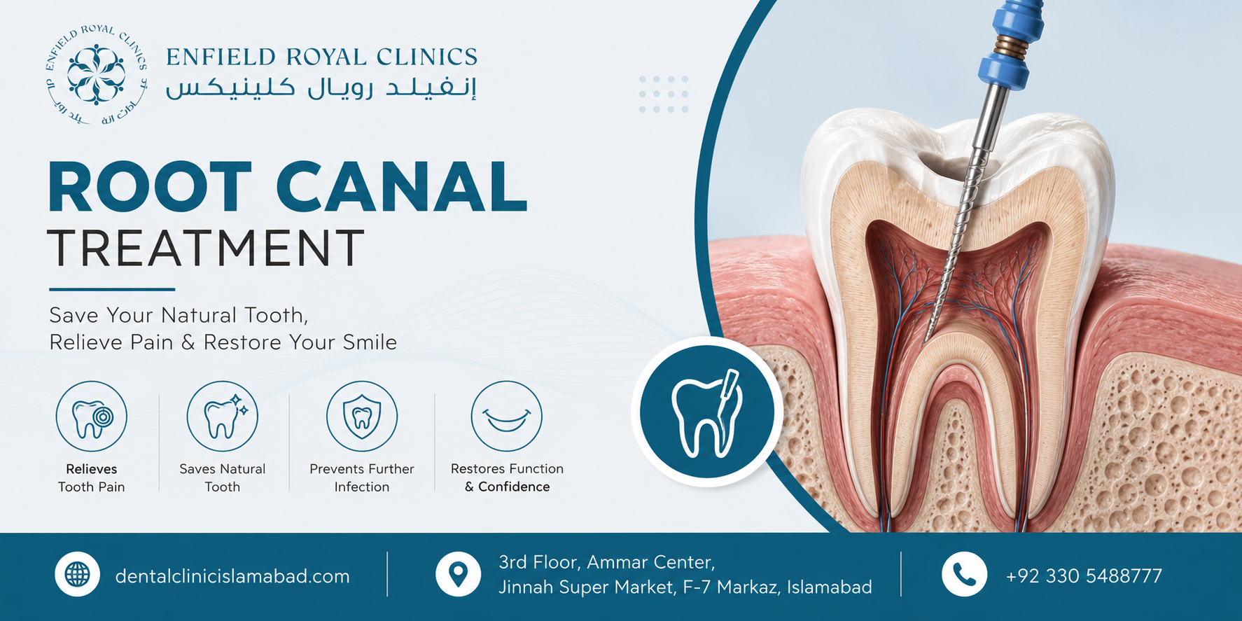 An Advanced Solution for Tooth Pain and Infection Root Canal Treatment in Islamabad Pakistan: