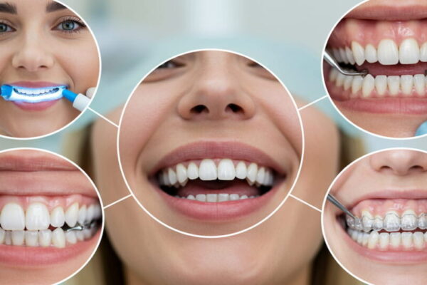 cosmetic dentist in bandra