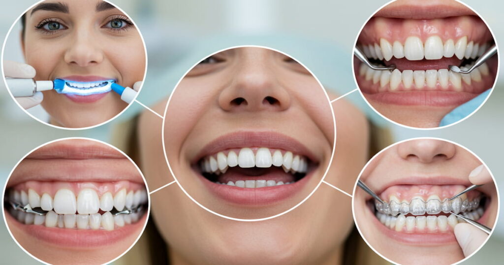 cosmetic dentist in bandra