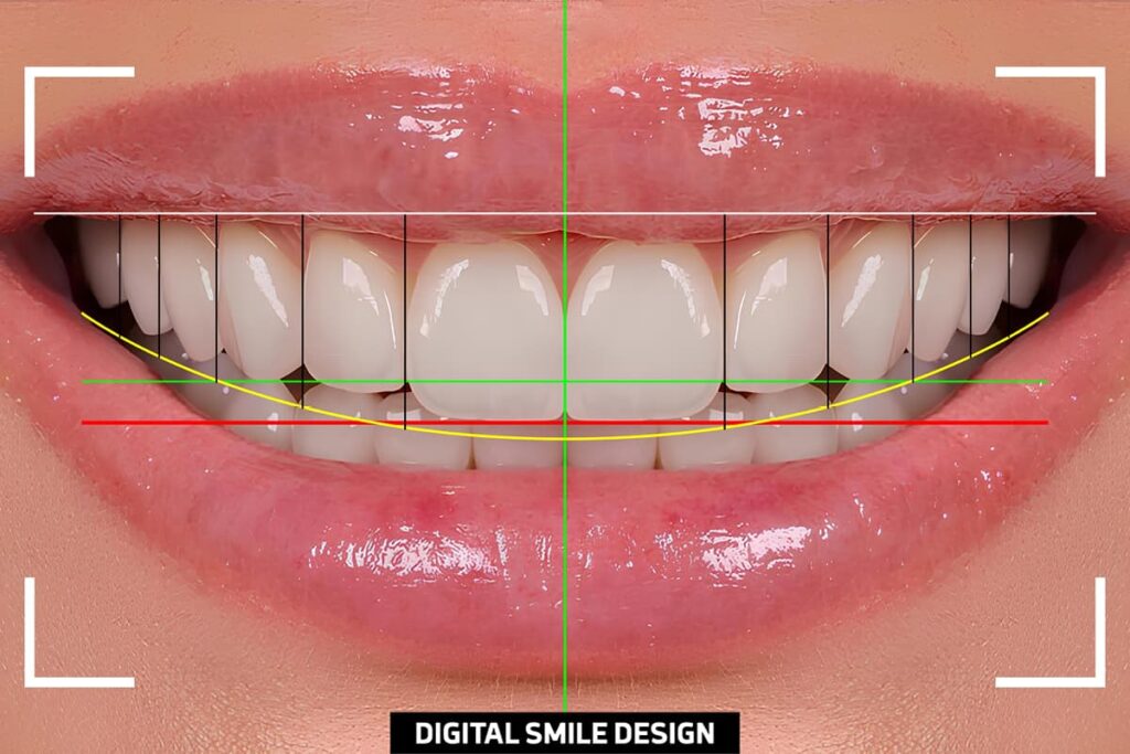 digital smile designing in hiranandani estate