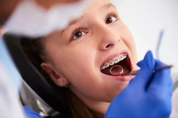 teeth braces cost in noida