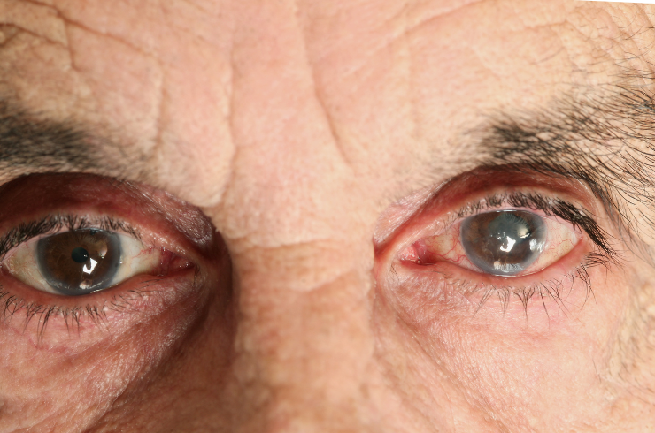 eye specialist pimpri chinchwad