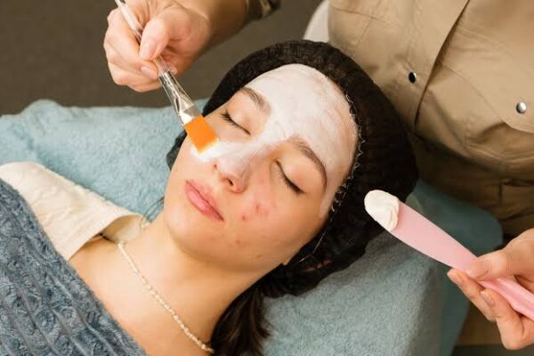 Acne Treatment in Bengaluru