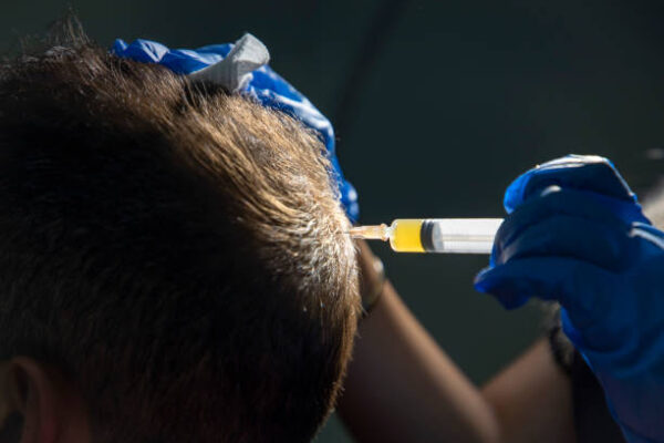 How Hair Care Habits Can Make or Break Your Results PRP Hair Treatment in Islamabad:
